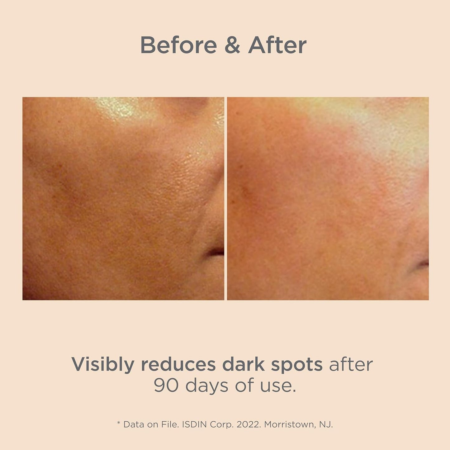 ISDIN Isdinceutics Melaclear – Dark Spot Correcting Serum - 30ml