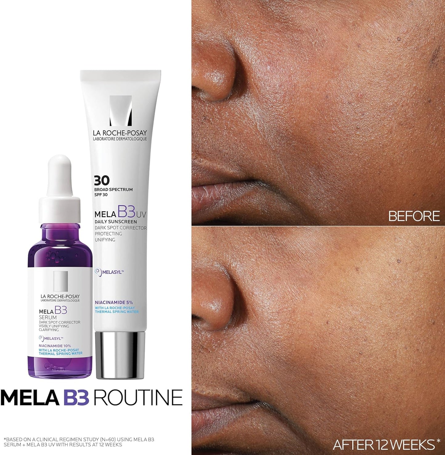 La Roche‑Posay MELA B3 Routine - Cleanse, Treat, Protect
